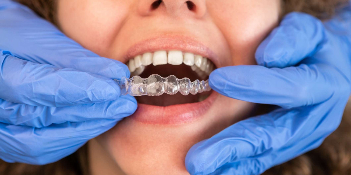 Handling Invisalign Issues with Emergency Dentist Support
