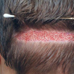 hair transplant in lahore Profile Picture