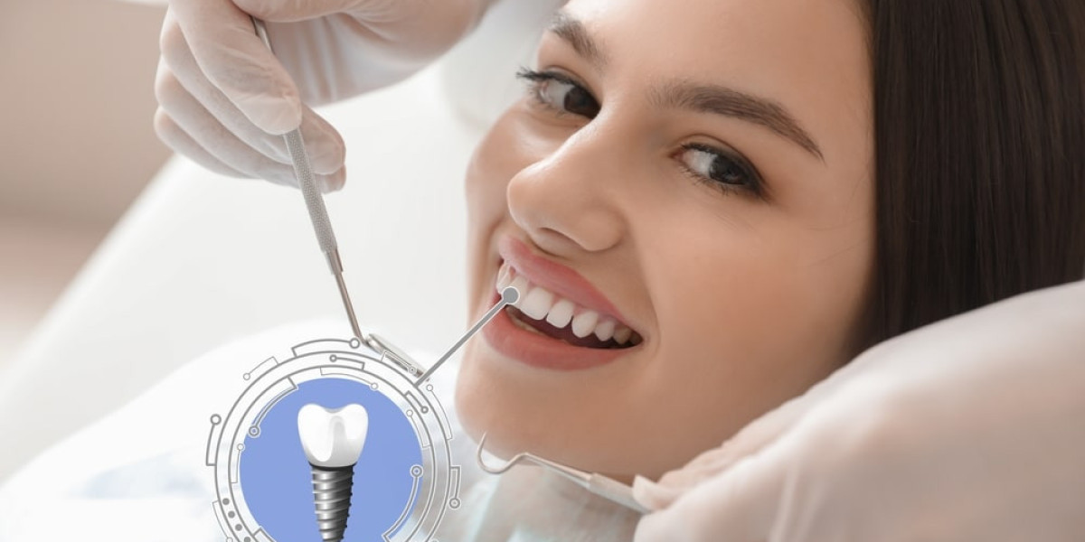 Zygomatic vs Traditional Dental Implants: Key Differences Explained