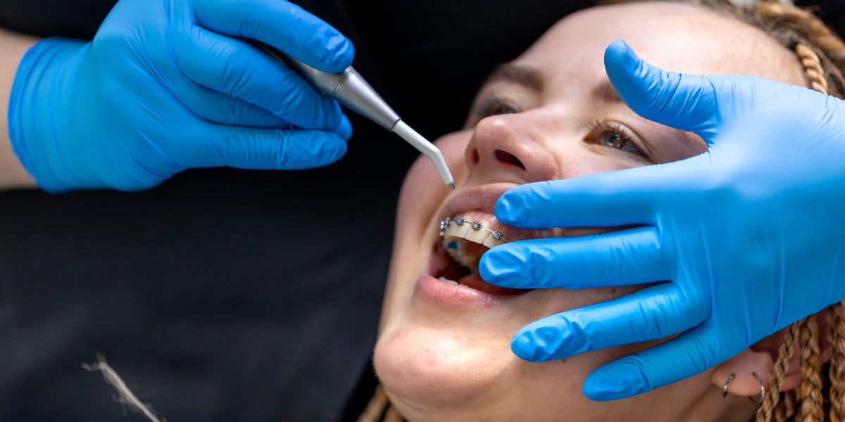 How Modern Orthodontics in Gaithersburg Is Changing the Way We Smile