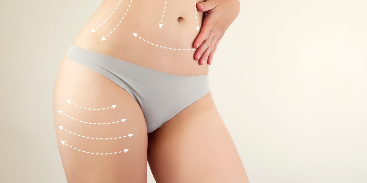 How to Prepare for Your Liposuction Procedure