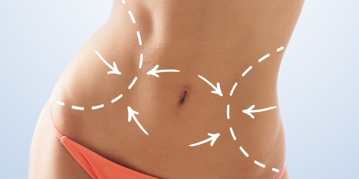 Does Liposuction Procedure Impact Fertility?