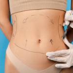 Liposuction procedure in Riyadh Profile Picture