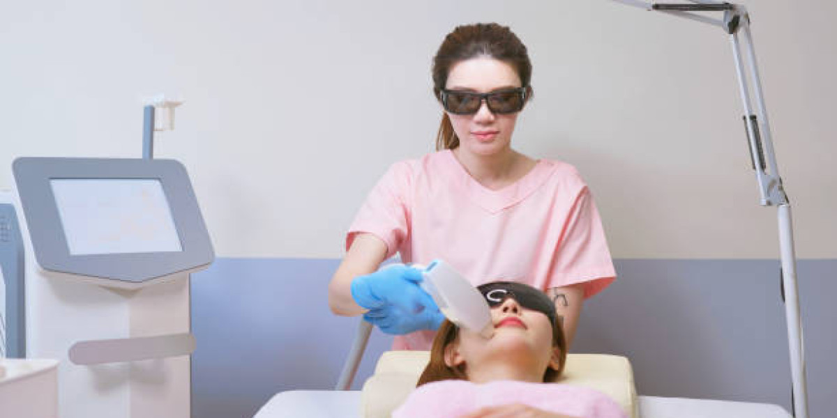 Does Q-Switch Laser Prevent Lip Pigmentation Recurrence?