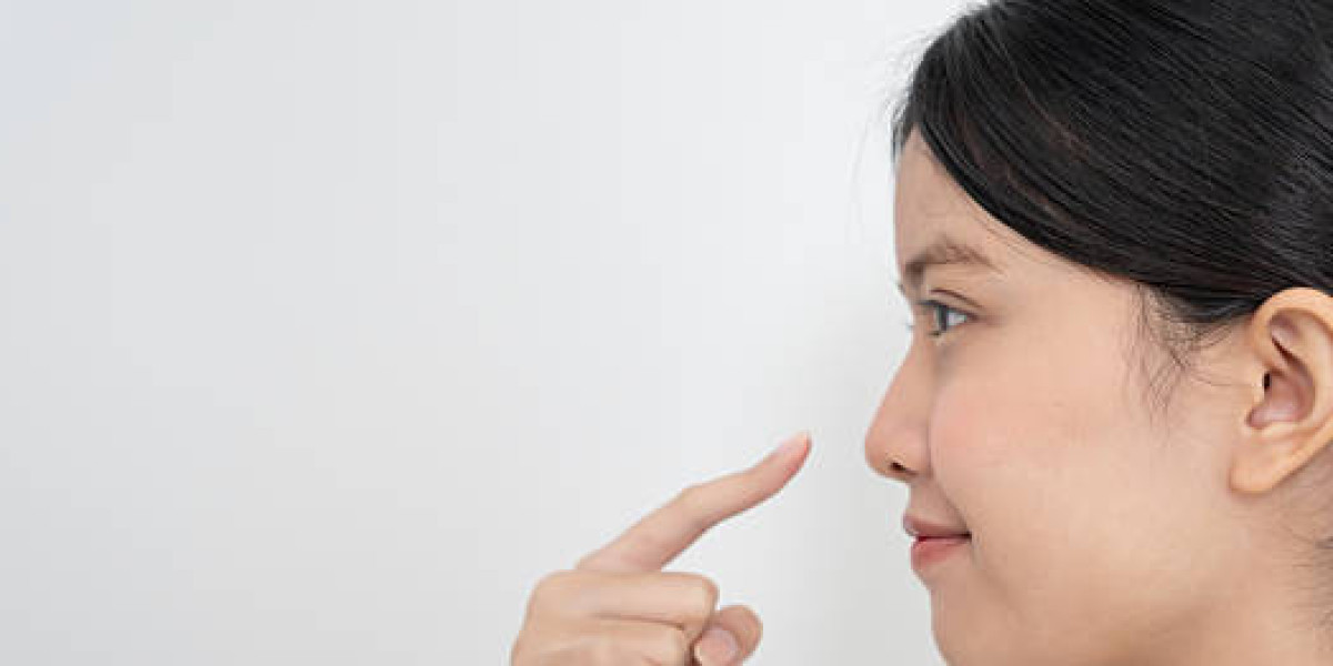 Home Remedies for Rhinoplasty Discomfort: Natural Relief Tips