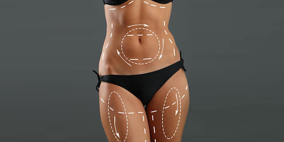 The Science Behind Liposuction: How Fat Removal Really Works
