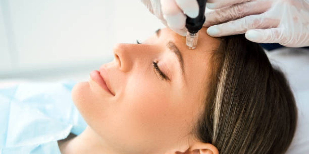 Electrolysis Hair Removal for Light and Dark Hair