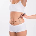 Liposuction procedure in Riyadh Profile Picture