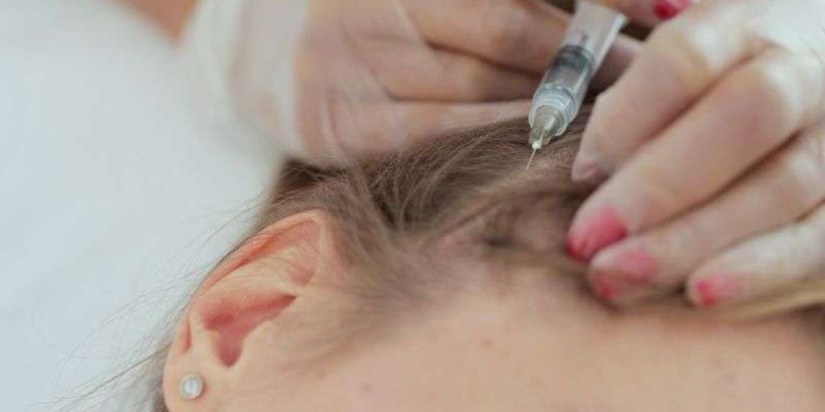 Exosome-Based Solutions for Thinning Hair