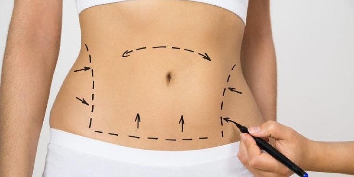 What Myths Debunk Liposuction Procedure Fears?