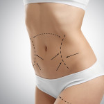 liposuction in Riyadh saudia profile picture