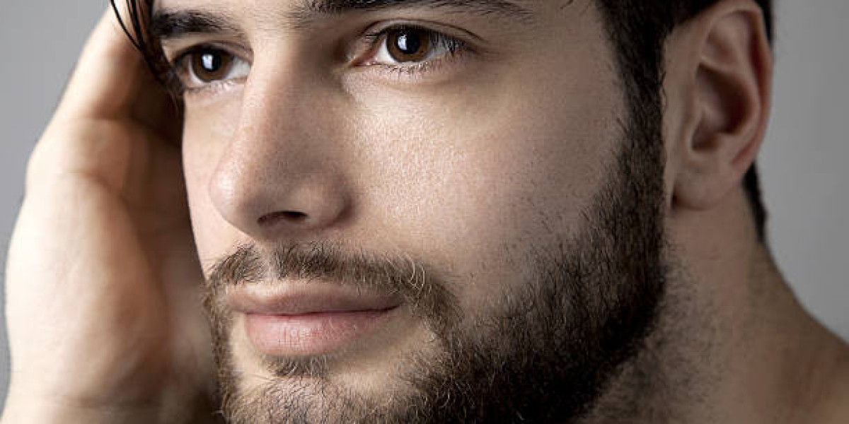 Beard Hair Transplant for Achieving a Dense Masculine Look