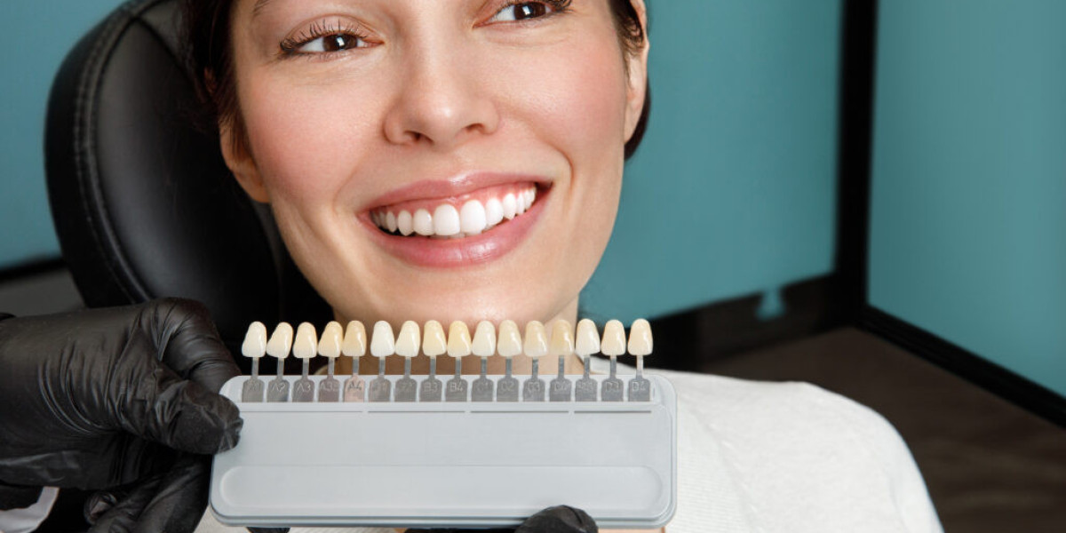 How Dental Crowns Can Save and Strengthen Damaged Teeth