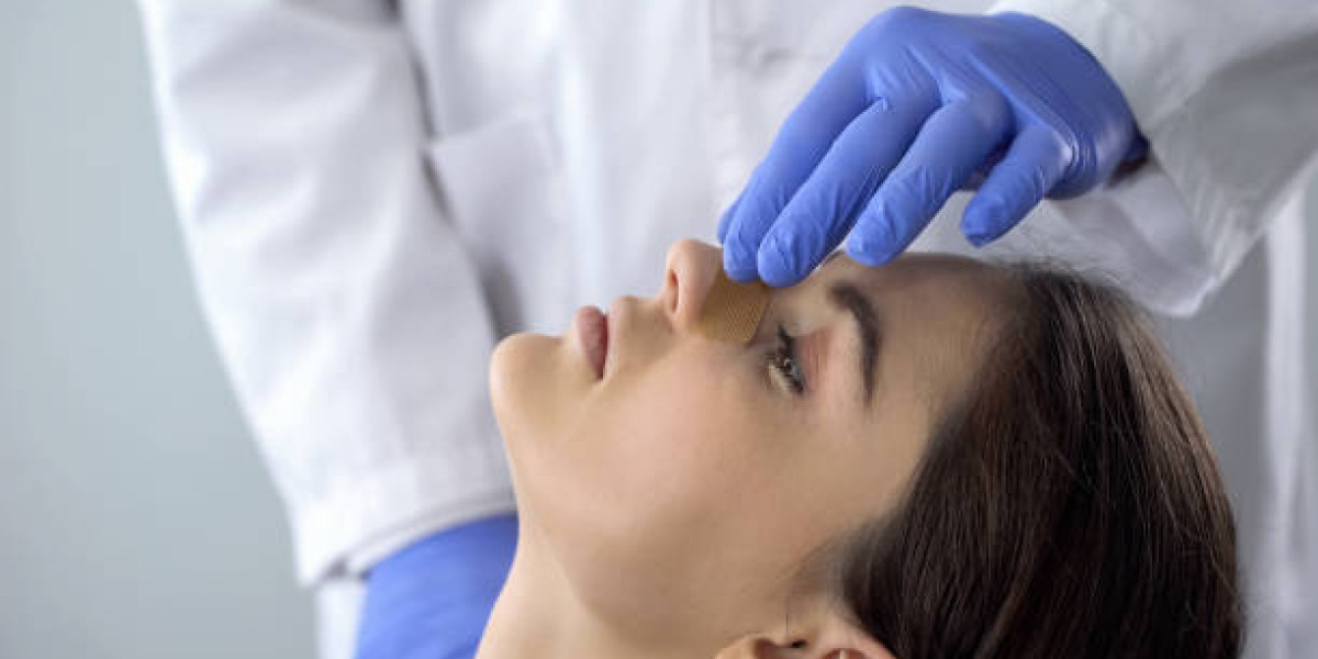 Does Rhinoplasty Heighten Touch Sensitivity?