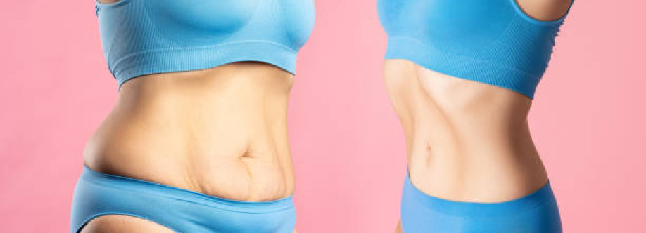 Liposuction in Riyadh saudia Cover Image