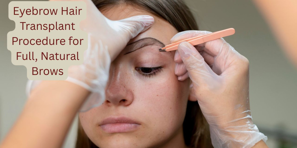 Eyebrow Hair Transplant Procedure for Full, Natural Brows