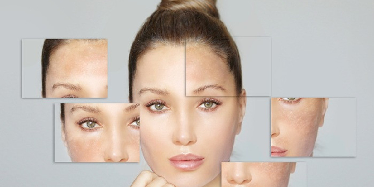 Pigmentation Specialist in Delhi – Expert Care for Clear and Even Skin Tone