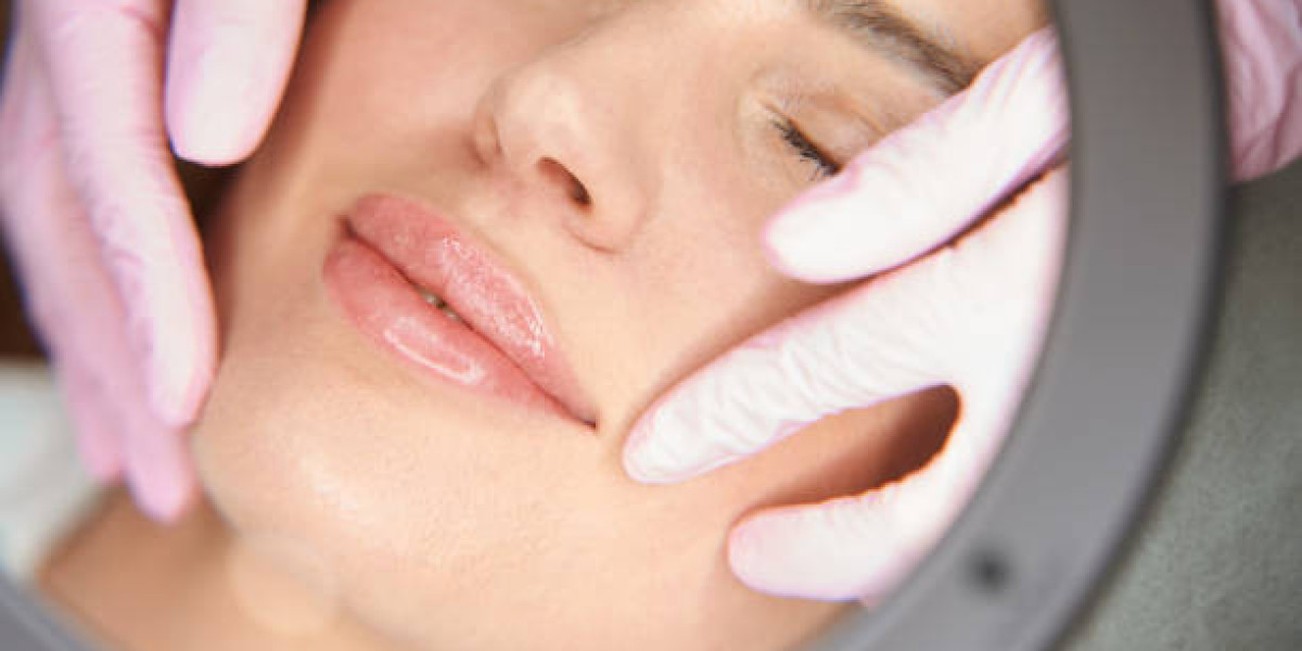 Lip Fillers Injection in Dubai: Best Practices & Common Mistakes
