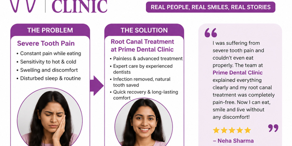 Dental Clinic Greater Noida | Advanced Care at Prime Dental Clinic