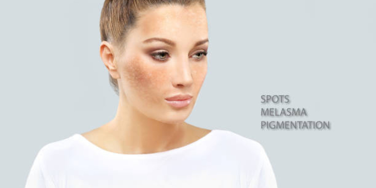 Effective Pigmentation Treatment in Dubai Results 2026