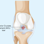 Centre for Sports Injury Profile Picture