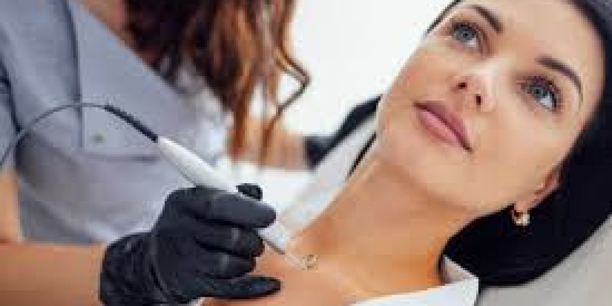 Mole Remvoal in Dubai Modern Skin Treatment Solutions