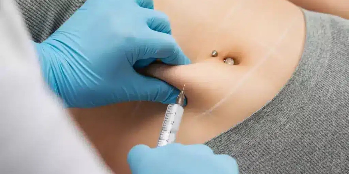 Aqualyx Injection: Can It Give You a Sleek and Toned Appearance?