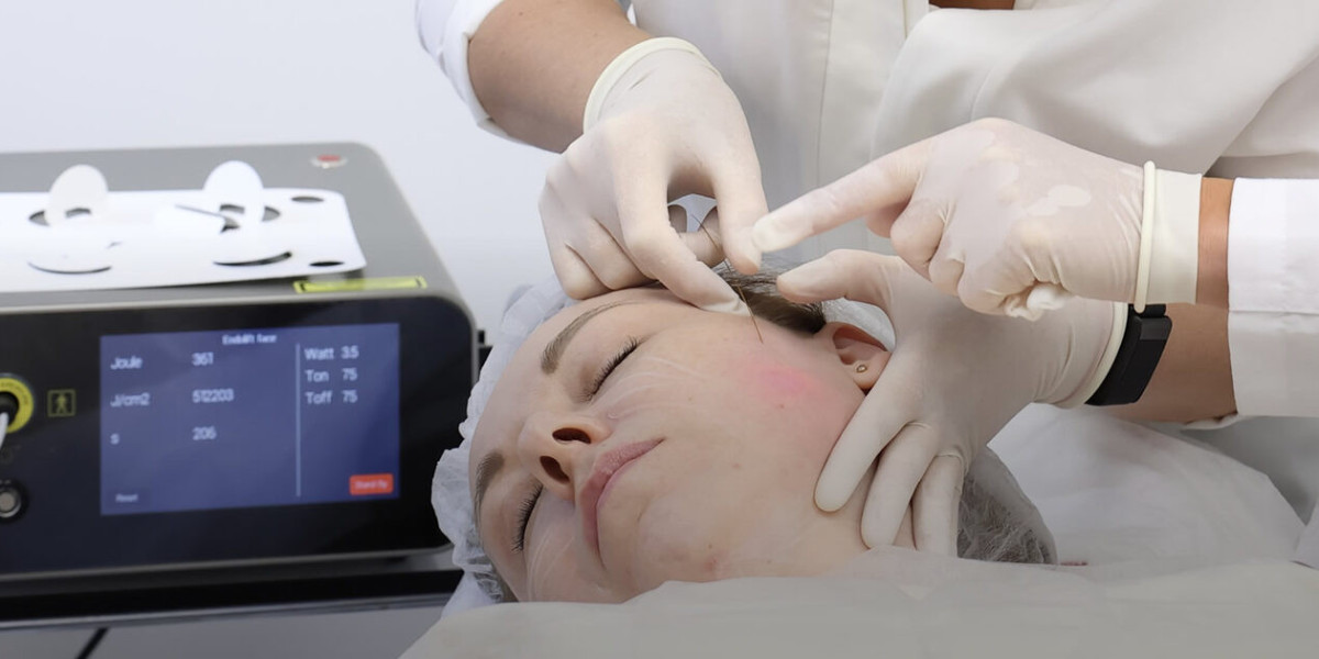 Endolift Treatment in Dubai as Face Lift Alternative Guide