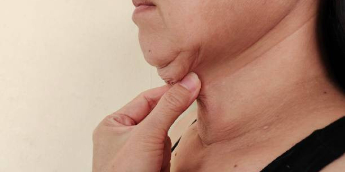 Endolift Treatment in Dubai vs. Ultherapy: Comparing Results