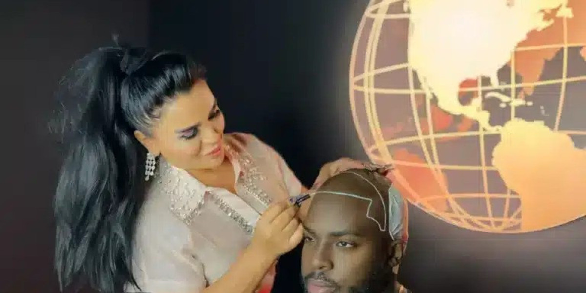 Hair Transplant Turkey: Why International Patients Choose Turkey for Hair Restoration