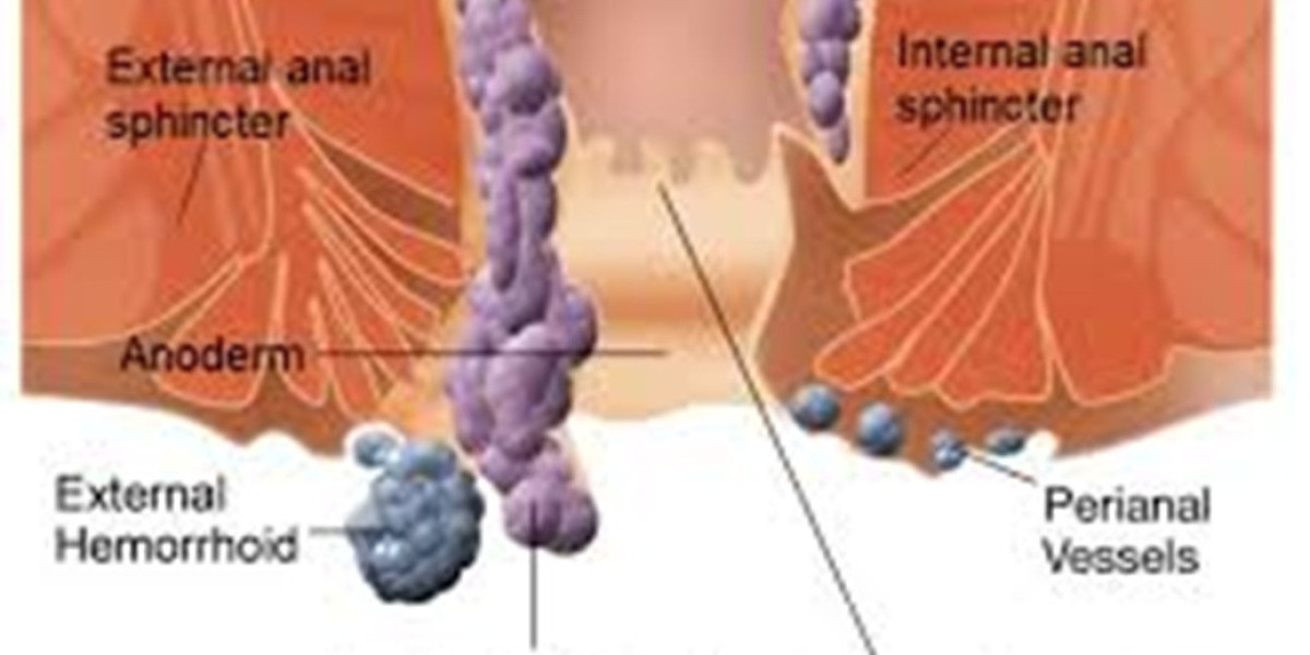 Trusted PAE Clinic for Advanced Prostate Artery Embolization Treatment