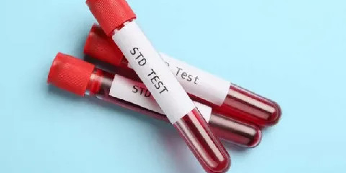 STD Test in Dubai: A Proactive Step for Long-Term Wellness