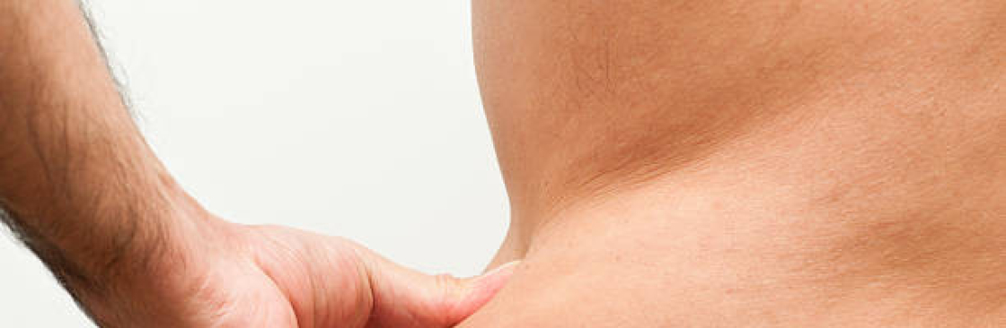 liposuction in riyadh Cover Image