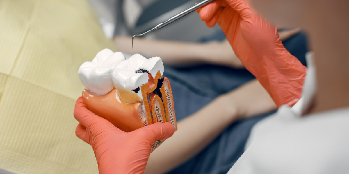 Root Canal Treatment Near Me – Expert Root Canal Specialist in Chandigarh