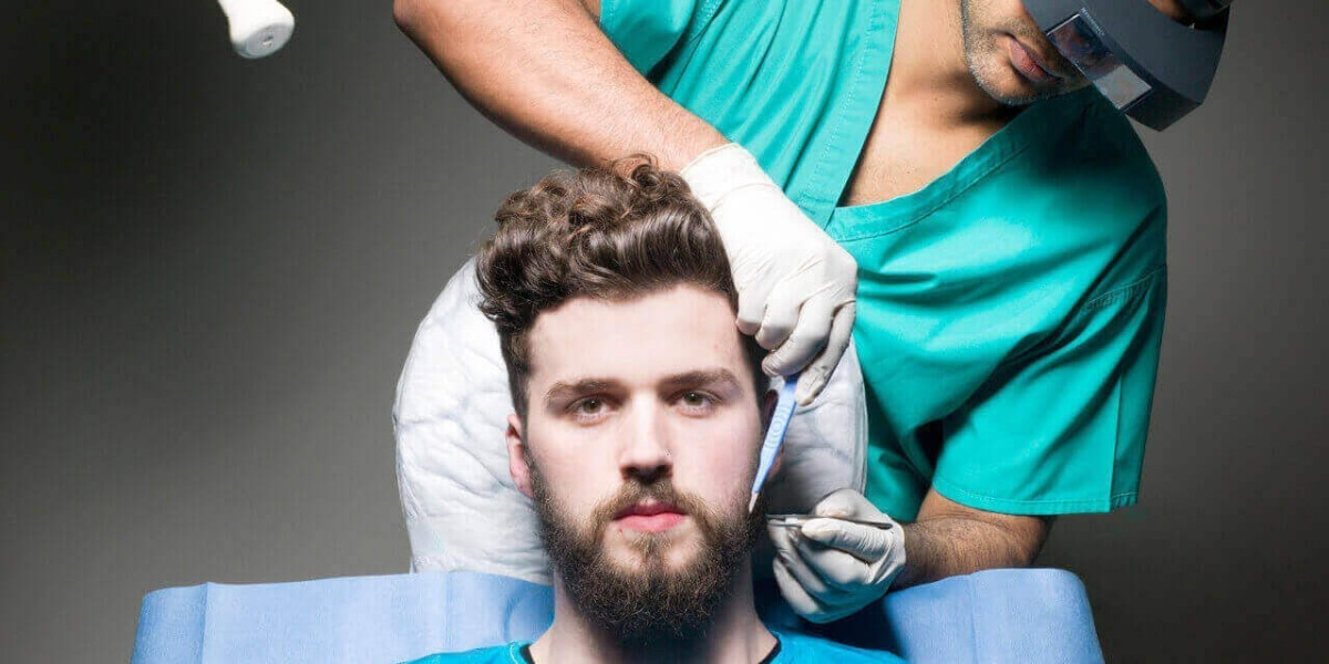 Beard styling options after full recovery