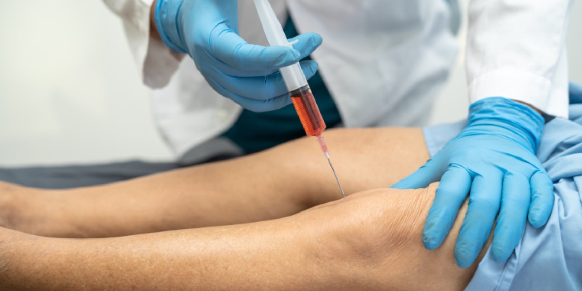PRP Knee Injections in Dubai Success Rate Explained