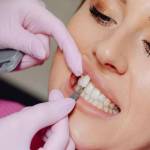 Dental Braces Price Global Facto Profile Picture