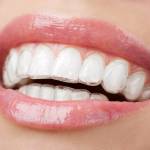 Invisible Braces Cost in Chennai Profile Picture