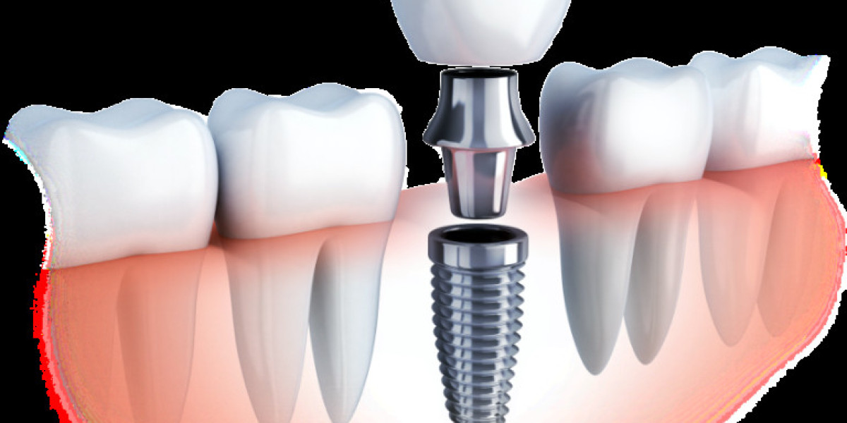 Dentist Earlwood NSW: Your Comprehensive Guide to Complete Dental Care