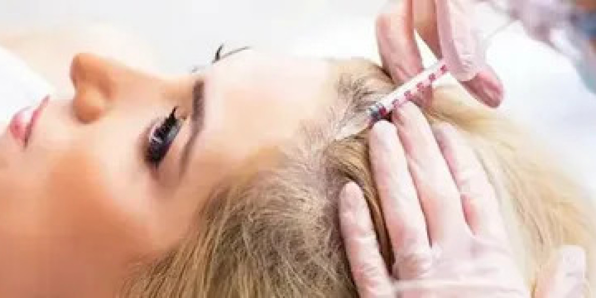 Hair Fillers in Dubai: A Targeted Approach to Hair Density