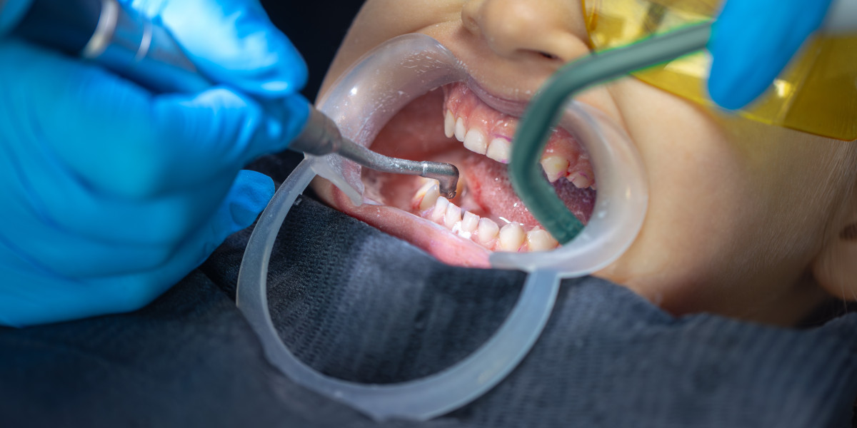 Advanced Techniques in Full-Mouth Dental Implants Near Me