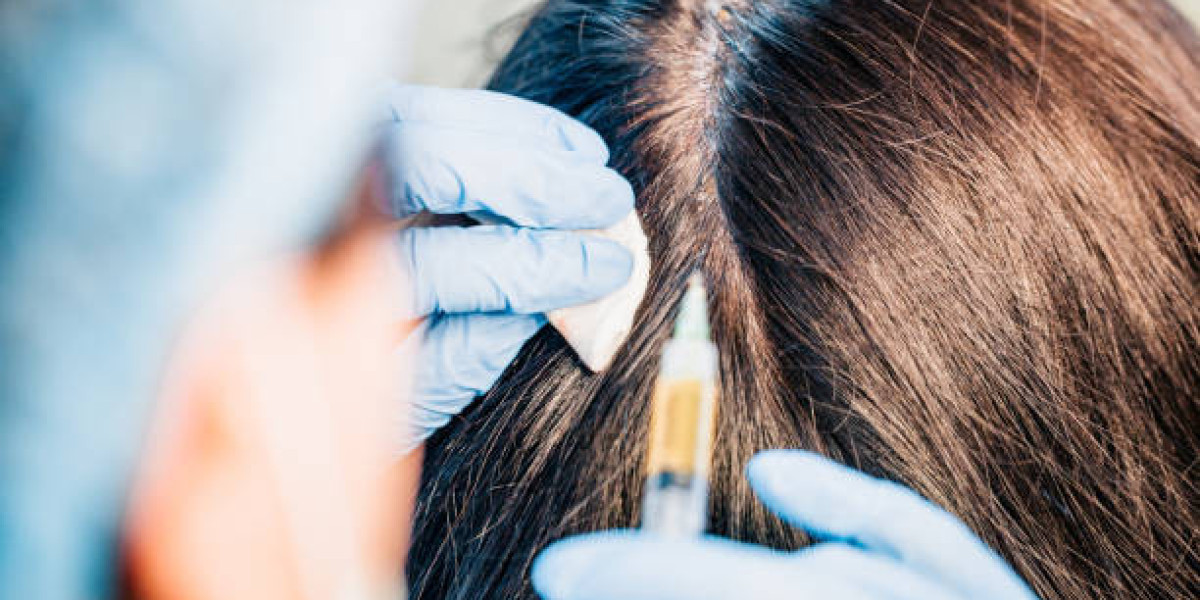 Exosome Hair in Dubai: Advanced Restoration for Density