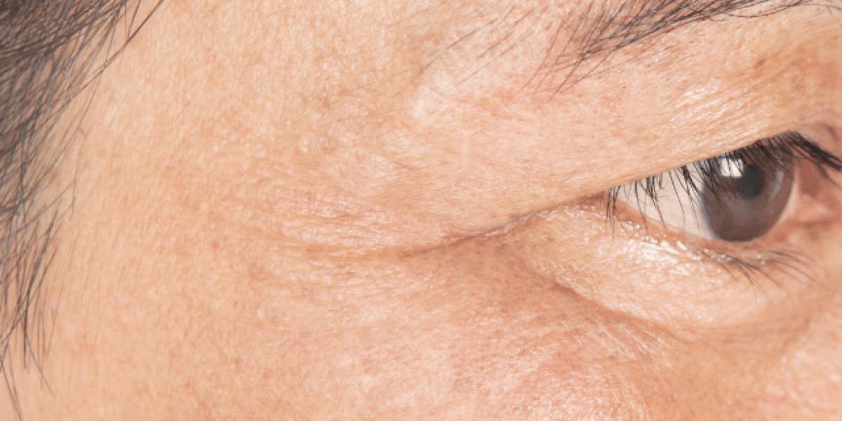 Achieve Natural-Looking Results with Dermal Fillers Birmingham UK and Lip Fillers Birmingham UK