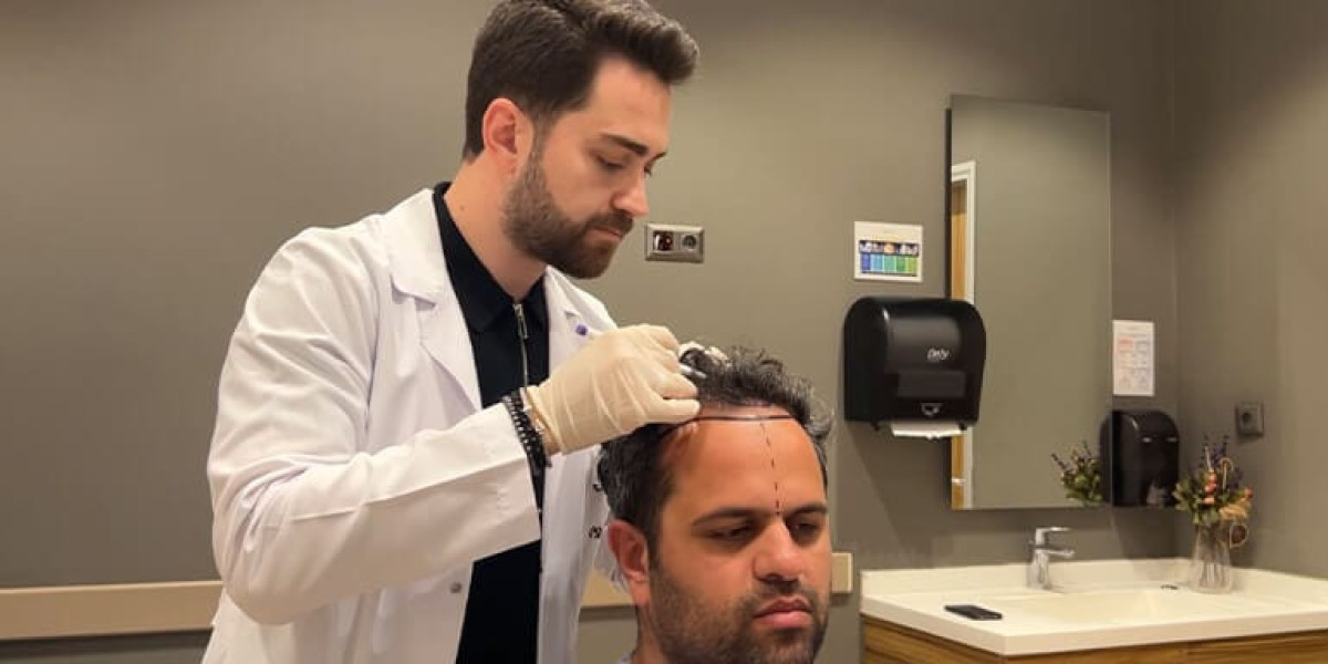 Hair Transplant in Dubai Male Pattern Baldness Solution