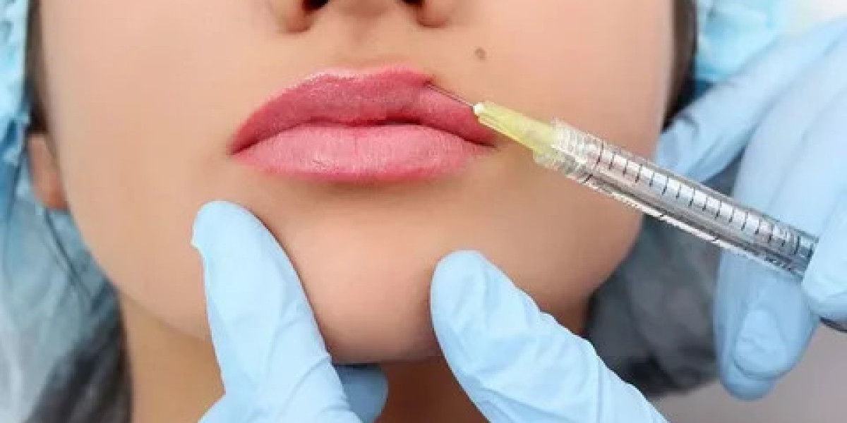 Volbella Fillers in Dubai: Modern Solutions for Volume