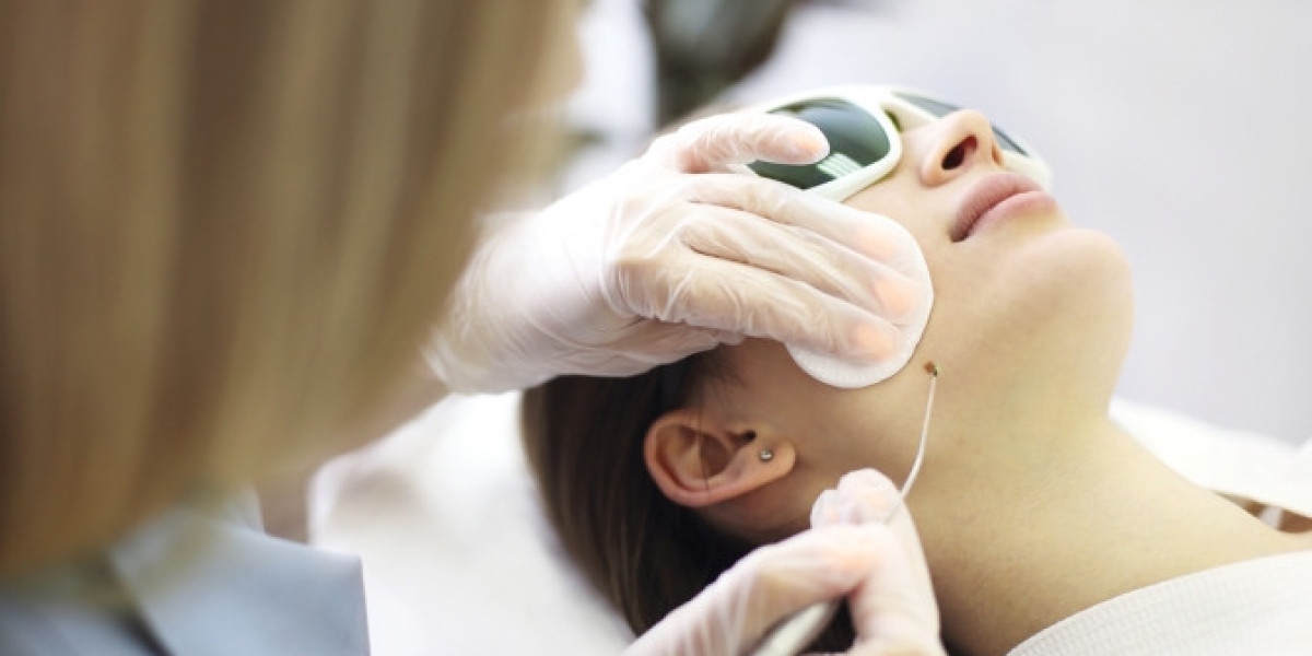 Cryotherapy: A Fast and Effective Method for Skin Lesion Removal in Riyadh