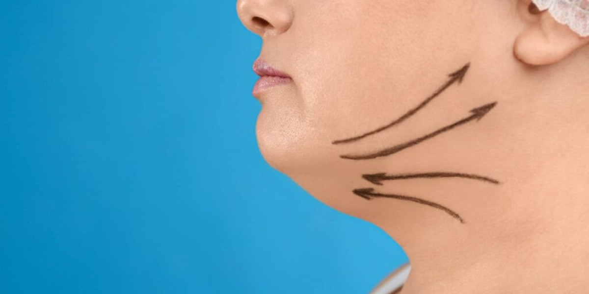 Neck Lift Surgery in Dubai: Common Questions Answered