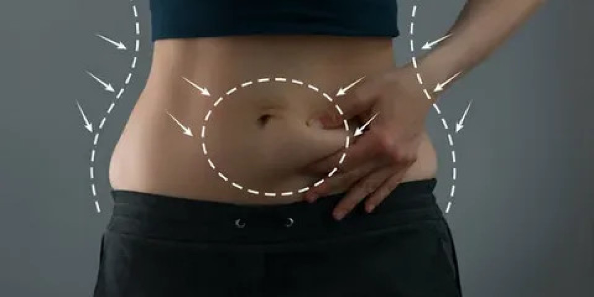 Tummy Tuck Surgery in Dubai: Surgical Excellence Explained