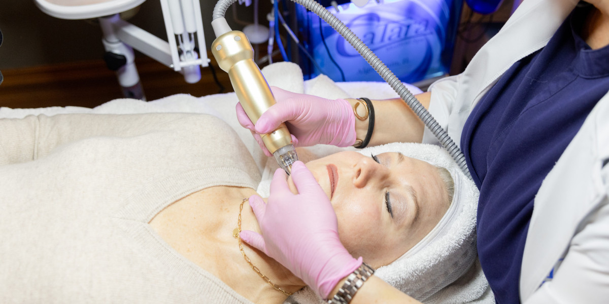 Microneedling with PRP in Dubai for Collagen Boost