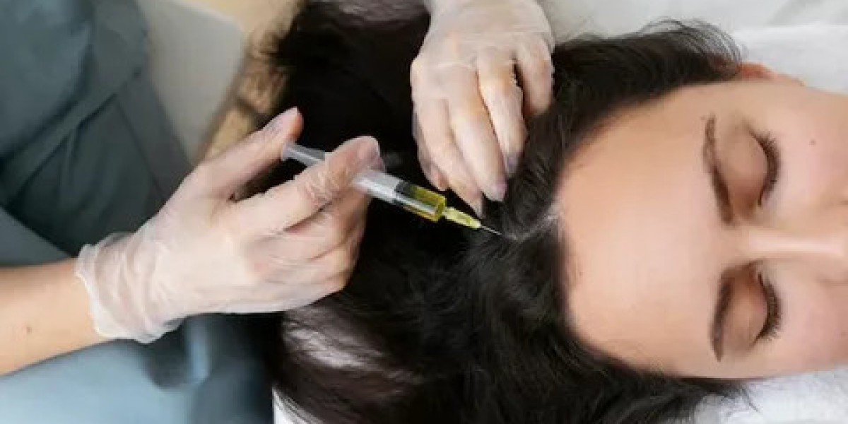 Professional PRP Hair Treatment in Dubai for Hair Loss
